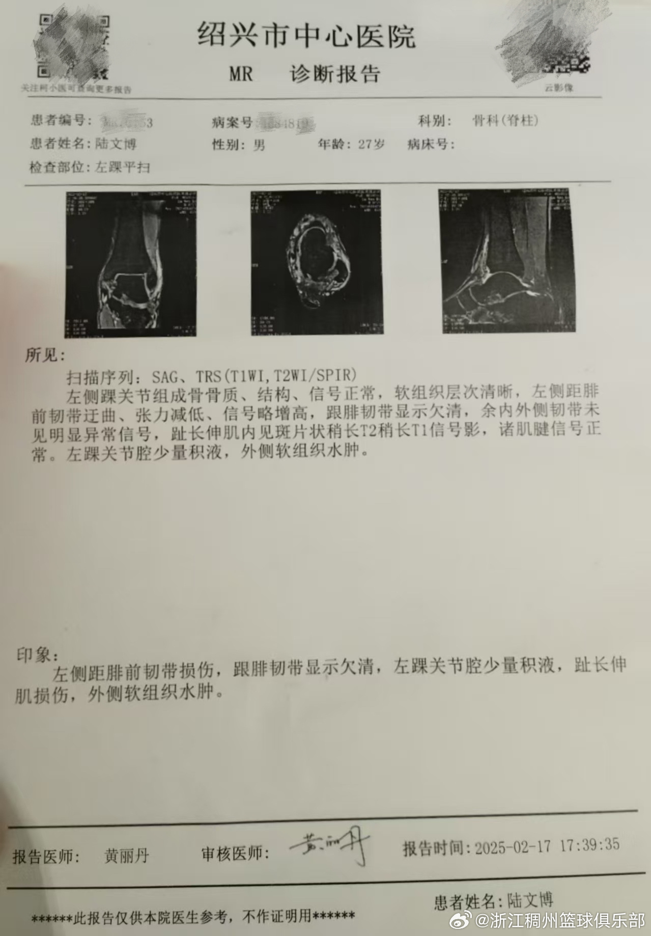 探讨瓜迪奥